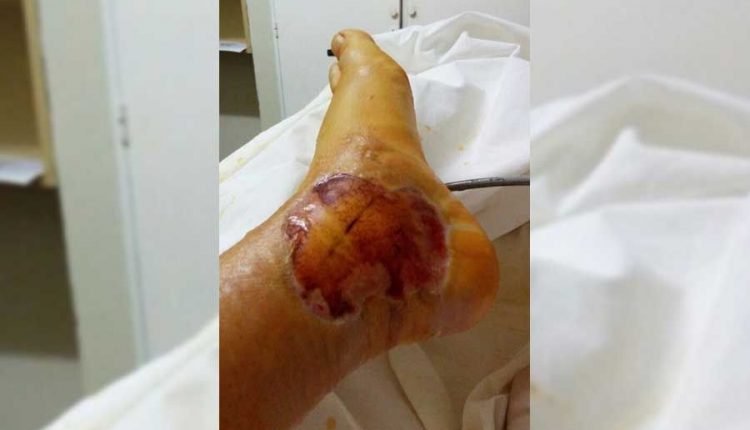 radio one Trasladaron a Bettina Garayalde al Sanatorio Güemes por una picadura